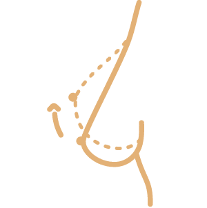 K-Láser